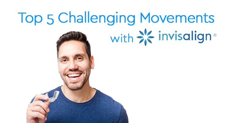Case Study: Improve Your Invisalign® Results with These Tips